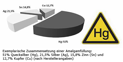 Zusammensetzung Amalgamfüllung