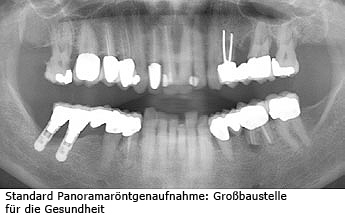 Röntgenaufnahme Mund