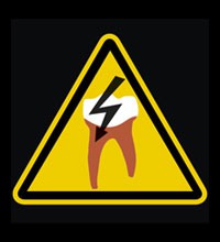 Die 20+ wurzelbehandelter zahn schmerzt nach jahren was tun